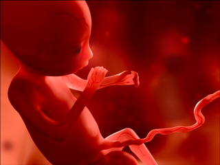 Abortion
